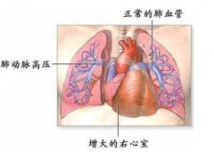 药物流产预防措施有哪些